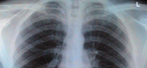 Can physiotherapy help with respiratory conditions? Can physiotherapy help with respiratory conditions?